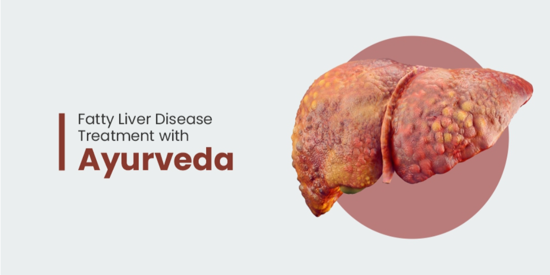 Ayurveda Medicine for Liver Health & Fatty Liver