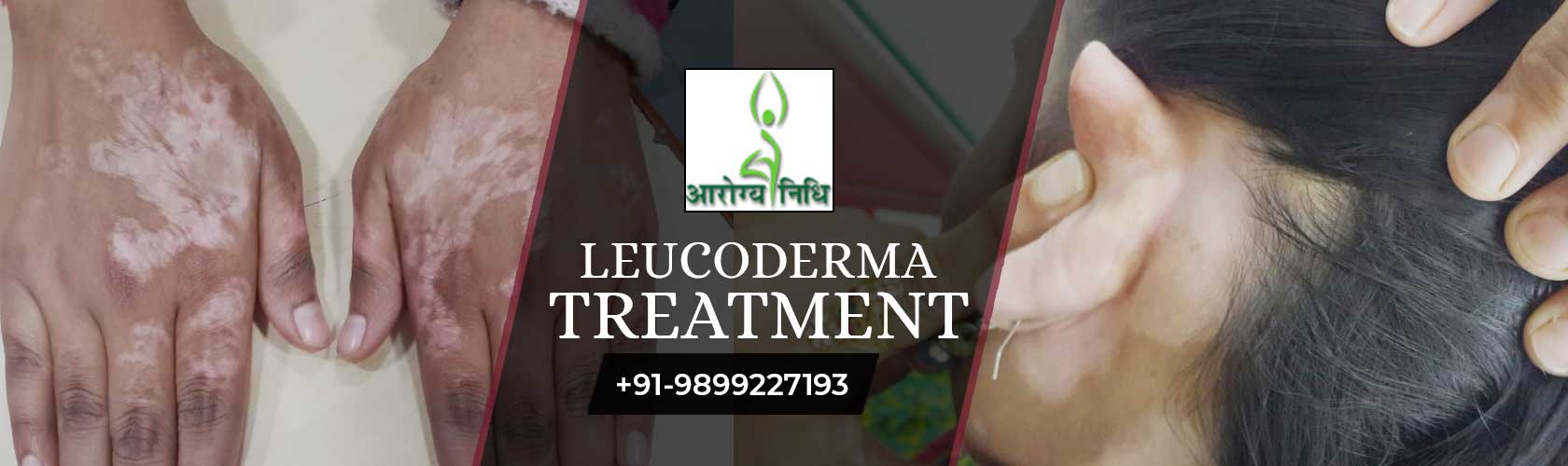 Best Ayurvedic Clinic in Delhi NCR