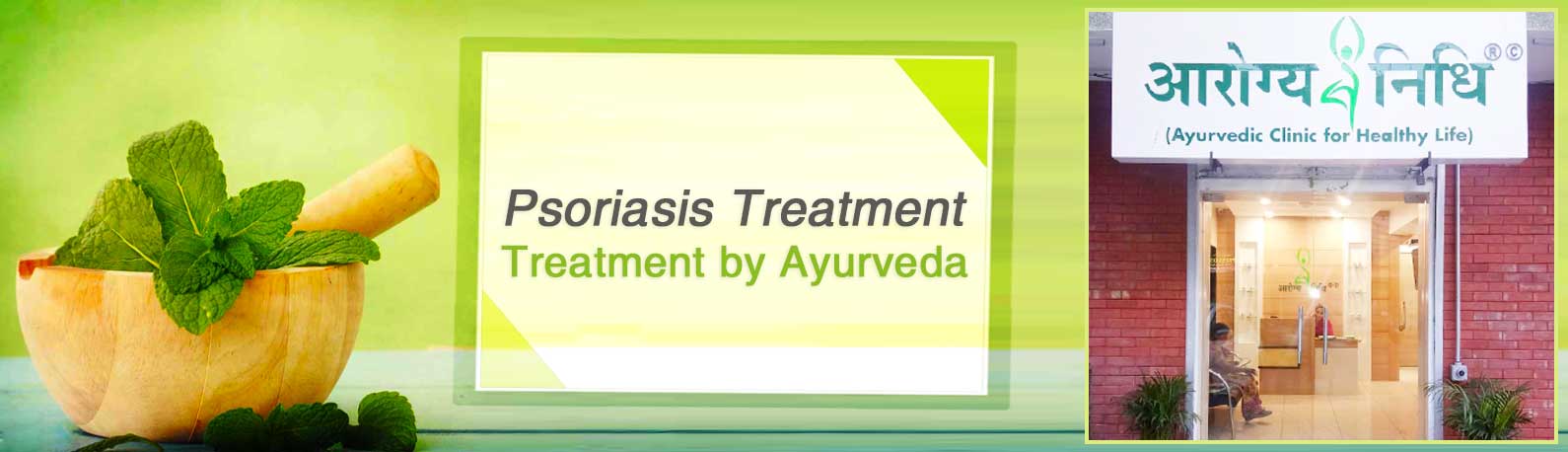 Psoriasis Treatments